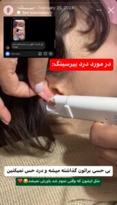 نمونه کار پیرسینگ گوش دکتر تکتم گنجی در مشهد