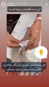 نمونه کار پیرسینگ گوش دکتر تکتم گنجی در مشهد