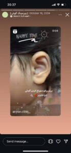 نمونه کار پیرسینگ گوش کلینیک آرمان در مشهد