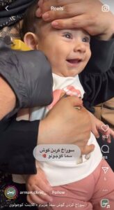 نمونه کار پیرسینگ گوش کلینیک آرمان در مشهد