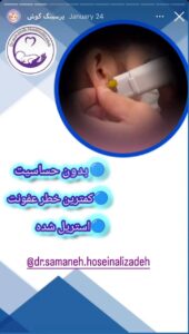 نمونه کار پیرسینگ گوش دکتر ثمانه حسینعلی زاده در مشهد