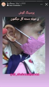 نمونه کار پیرسینگ گوش دکتر شهرزاد پرویزی در مشهد