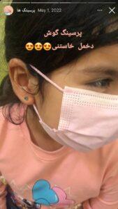 نمونه کار پیرسینگ گوش دکتر شهرزاد پرویزی در مشهد