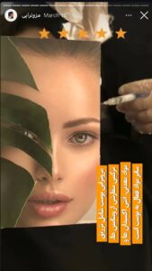 نمونه کار مزوتراپی دکتر مهدی رزم آرا در مشهد