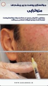 نمونه کار مزوتراپی کلینیک گهربد در مشهد