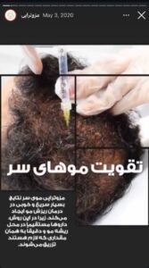 نمونه کار مزوتراپی کلینیک گهربد در مشهد