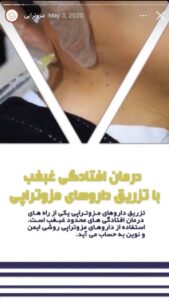 نمونه کار مزوتراپی کلینیک گهربد در مشهد