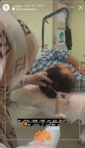 نمونه کار مزوتراپی کلینیک سی گل در مشهد
