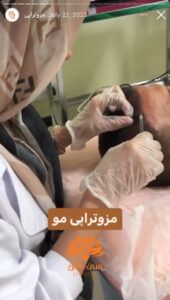 نمونه کار مزوتراپی کلینیک سی گل در مشهد