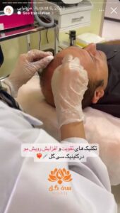 نمونه کار مزوتراپی کلینیک سی گل در مشهد