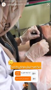 نمونه کار مزوتراپی کلینیک سی گل در مشهد