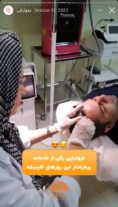 نمونه کار مزوتراپی کلینیک سی گل در مشهد