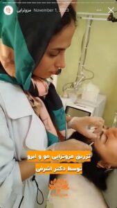 نمونه کار مزوتراپی کلینیک سی گل در مشهد