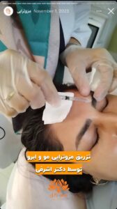 نمونه کار مزوتراپی کلینیک سی گل در مشهد