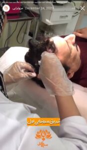 نمونه کار مزوتراپی کلینیک سی گل در مشهد