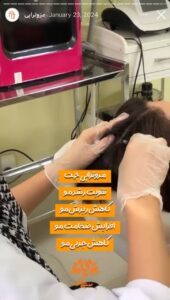 نمونه کار مزوتراپی کلینیک سی گل در مشهد