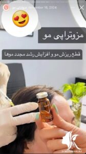 نمونه کار مزوتراپی دکتر مژگان کلالی در مشهد
