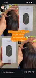 نمونه کار مزوتراپی دکتر مژگان کلالی در مشهد