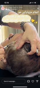 نمونه کار مزوتراپی دکتر مژگان کلالی در مشهد