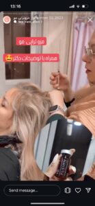 نمونه کار مزوتراپی دکتر مژگان کلالی در مشهد
