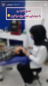نمونه کار مزوتراپی دکتر الهه اندخشیده در مشهد