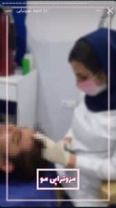نمونه کار مزوتراپی دکتر الهه اندخشیده در مشهد