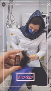 نمونه کار مزوتراپی دکتر الهه اندخشیده در مشهد