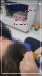 نمونه کار مزوتراپی دکتر الهه اندخشیده در مشهد