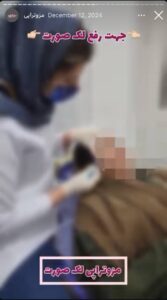 نمونه کار مزوتراپی دکتر الهه اندخشیده در مشهد