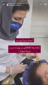 نمونه کار مزوتراپی دکتر الهه اندخشیده در مشهد