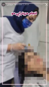 نمونه کار مزوتراپی دکتر الهه اندخشیده در مشهد