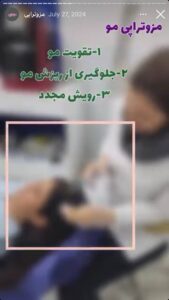 نمونه کار مزوتراپی دکتر الهه اندخشیده در مشهد