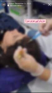 نمونه کار مزوتراپی دکتر الهه اندخشیده در مشهد