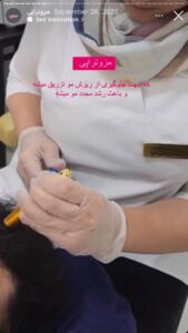 نمونه کار مزوتراپی دکتر الهه اندخشیده در مشهد
