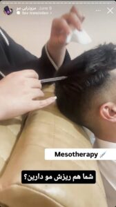 نمونه کار مزوتراپی دکتر فرشته طاهر در مشهد