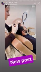 نمونه کار مزوتراپی دکتر فرشته طاهر در مشهد