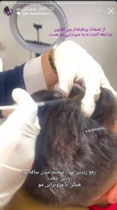 نمونه کار مزوتراپی دکتر فرشته طاهر در مشهد