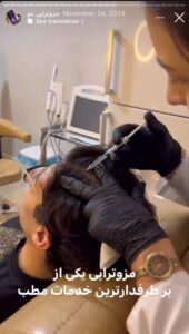 نمونه کار مزوتراپی دکتر فرشته طاهر در مشهد