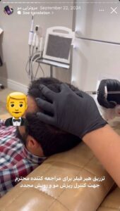نمونه کار مزوتراپی دکتر فرشته طاهر در مشهد