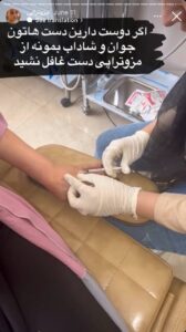 نمونه کار مزوتراپی دکتر فرشته طاهر در مشهد