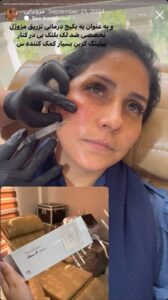 نمونه کار مزوتراپی دکتر فرشته طاهر در مشهد