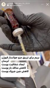 نمونه کار مزوتراپی دکتر صهبا صمدی در مشهد
