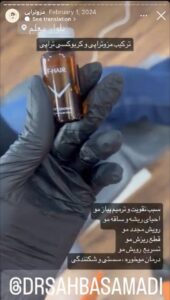 نمونه کار مزوتراپی دکتر صهبا صمدی در مشهد