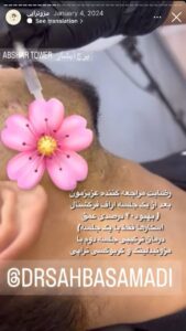 نمونه کار مزوتراپی دکتر صهبا صمدی در مشهد
