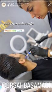 نمونه کار مزوتراپی دکتر صهبا صمدی در مشهد