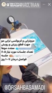 نمونه کار مزوتراپی دکتر صهبا صمدی در مشهد