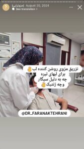 نمونه کار مزوتراپی دکتر فرانک تهرانی در مشهد