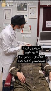 نمونه کار مزوتراپی دکتر فرانک تهرانی در مشهد