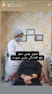 نمونه کار مزوتراپی دکتر فرانک تهرانی در مشهد