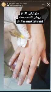 نمونه کار مزوتراپی دکتر فرانک تهرانی در مشهد